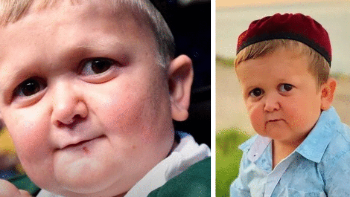 Hasbulla net worth lifestyle and fame photo 2025