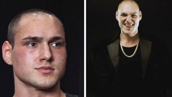 Leo Skepi net worth explained